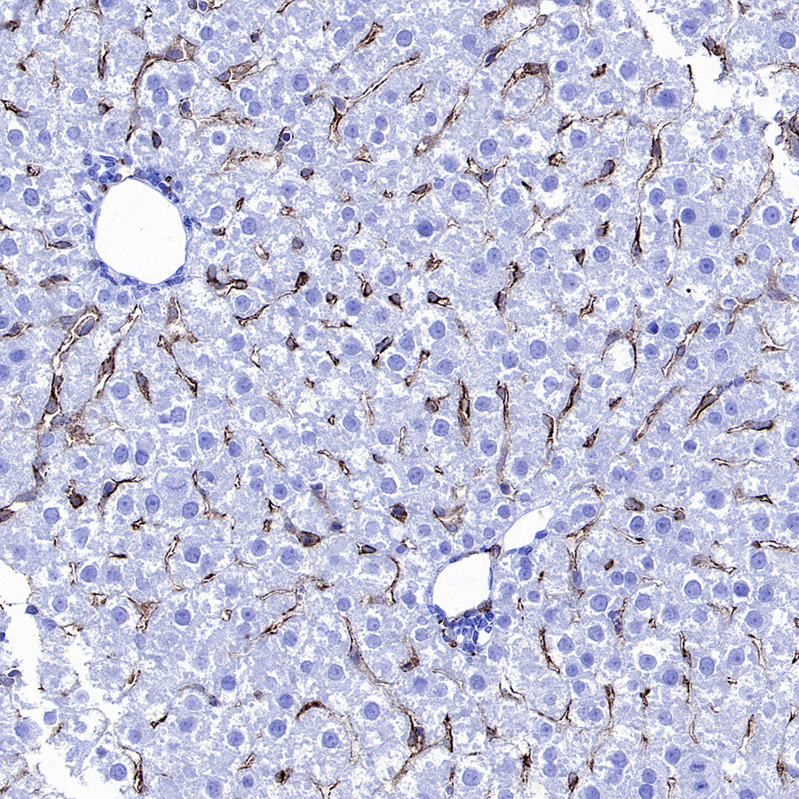 CD206 Recombinant Rabbit mAb (S-3477-27)