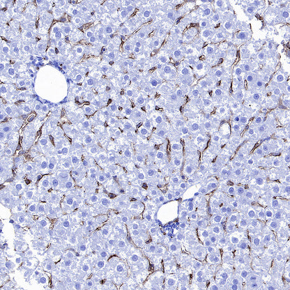 CD206 Recombinant Rabbit mAb (S-3477-27)