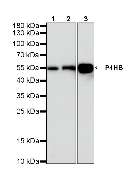 P4HB Recombinant Rabbit mAb