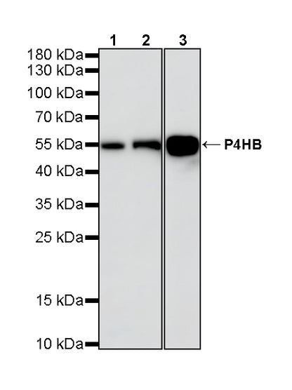 P4HB Recombinant Rabbit mAb