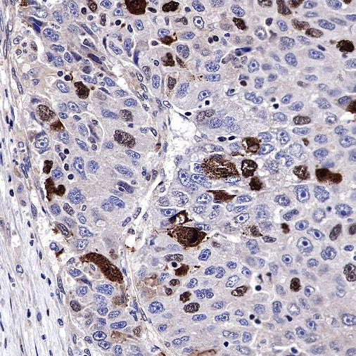 Phospho-IκBα (Ser36) Recombinant Rabbit mAb (S-R102)