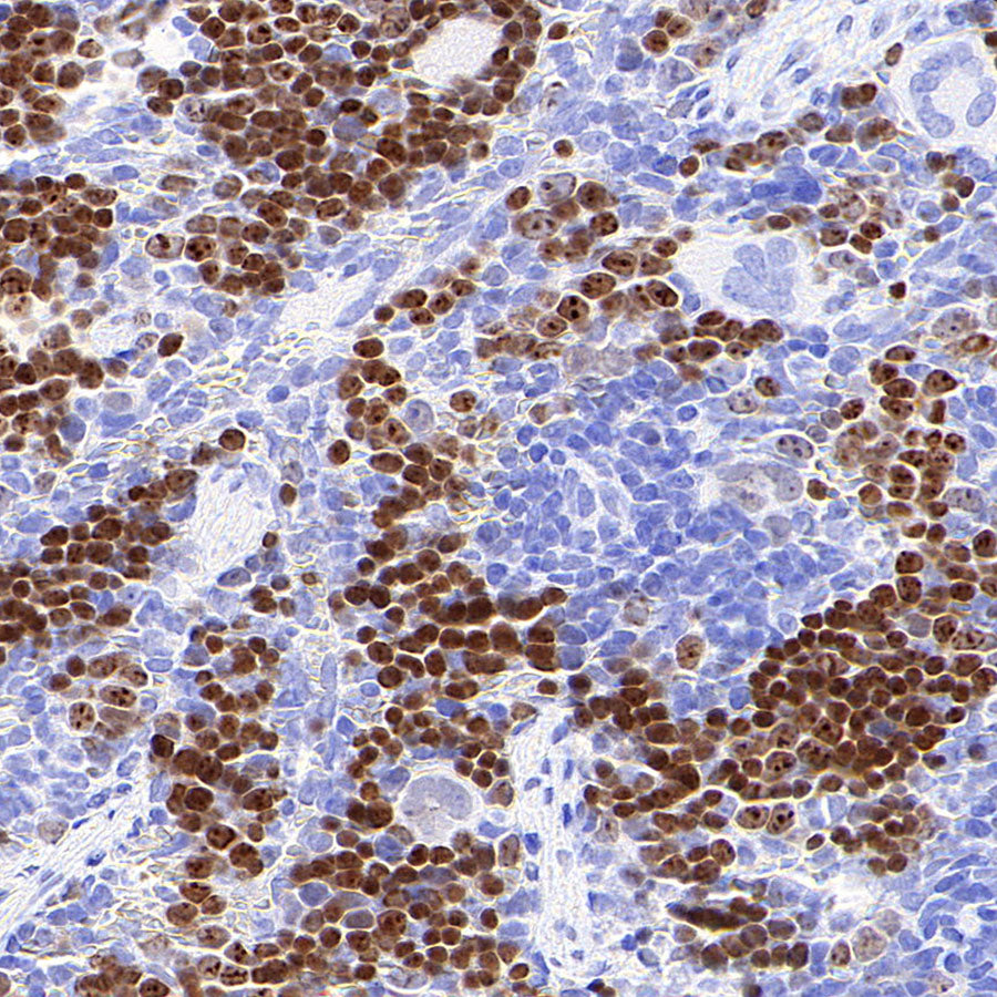 Ki67 Recombinant Rabbit mAb (S-4923-15)