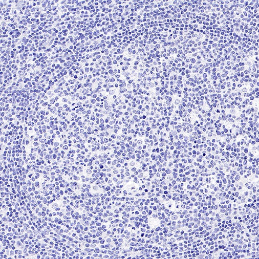 Mouse mAb IgM, κ Isotype Control (S-844-28)