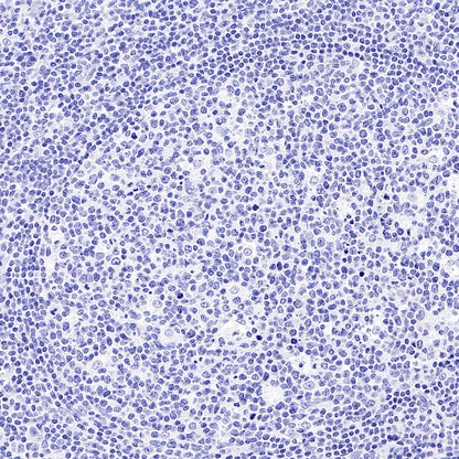 Mouse mAb IgM, κ Isotype Control (S-844-28)