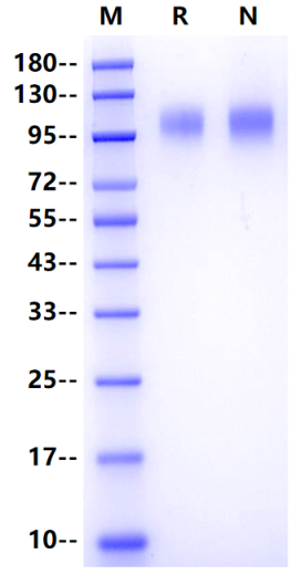 GP120 (group M/subtype B/Isolate MN) His Tag Protein, HIV-1
