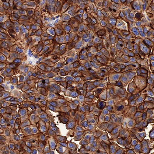 Human folate receptor alpha Recombinant Rabbit mAb (SDT-719-20-2)