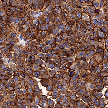 Human folate receptor alpha Recombinant Rabbit mAb (SDT-719-20-2)