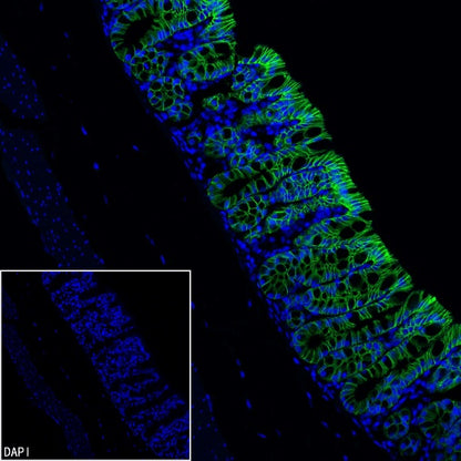 EpCAM Recombinant Rabbit mAb (Alexa Fluor® 488 Conjugate) (S-078-128)