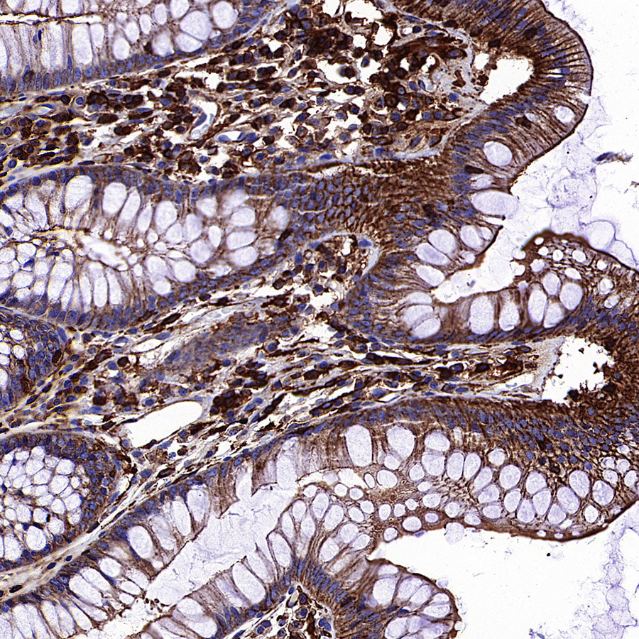 β-Actin Recombinant Rabbit mAb (S-5701)