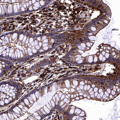 β-Actin Recombinant Rabbit mAb (S-5701)