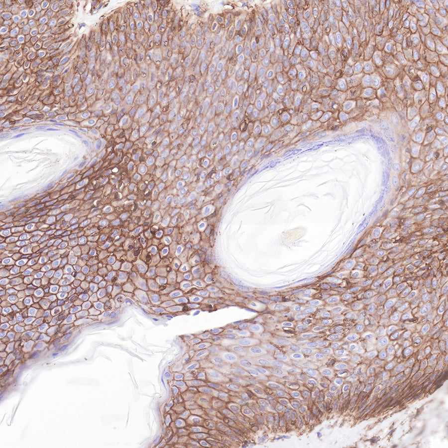 Beta 2 microglobulin Recombinant rabbit mAb (SDT-096-100)