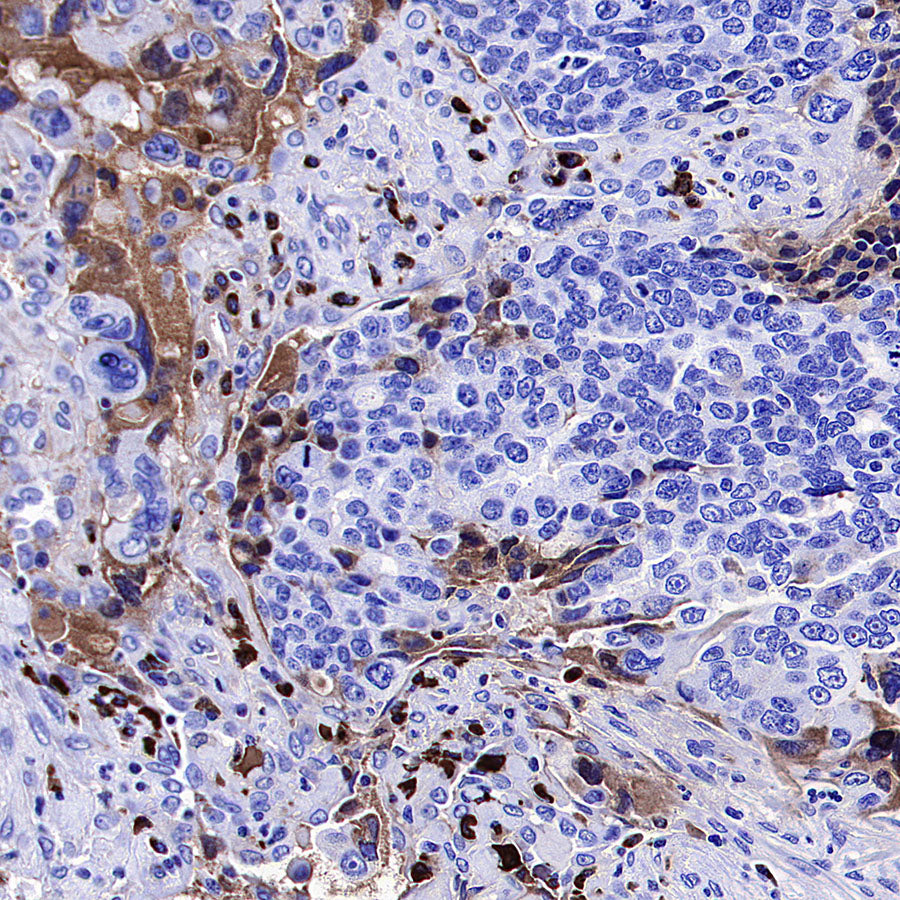 HEG1 Recombinant Rabbit mAb (S-4419-64)