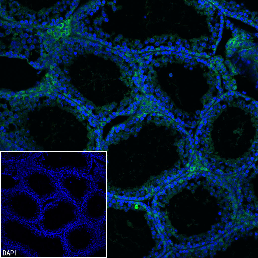 PGK1 Mouse mAb