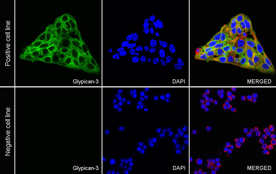 Glypican-3 Recombinant Rabbit mAb (SDT-4064-69-2)