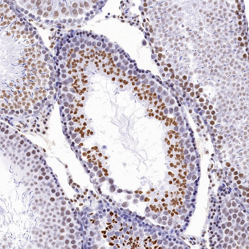 Histone H4 (acetyl K5) Recombinant Rabbit mAb (S-1464-112)