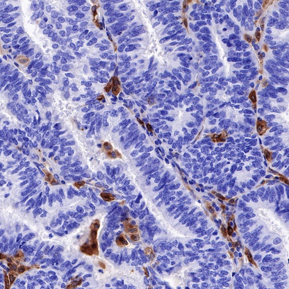 GPNMB Recombinant Rabbit mAb (S-R241)