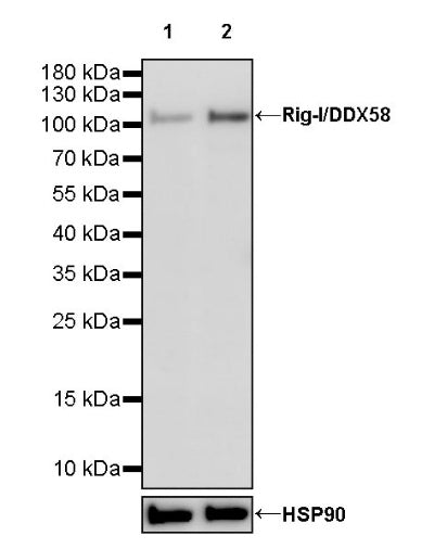 Rig-I/DDX58 Recombinant Rabbit mAb (S-1419-114)