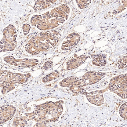S100A11 Recombinant Rabbit mAb (S-821-4)