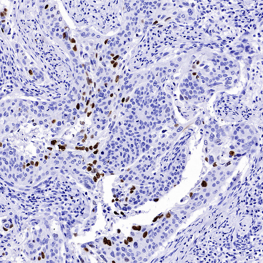 Phospho-DNA-PKcs (Ser2056) Recombinant Rabbit mAb (S-3813)