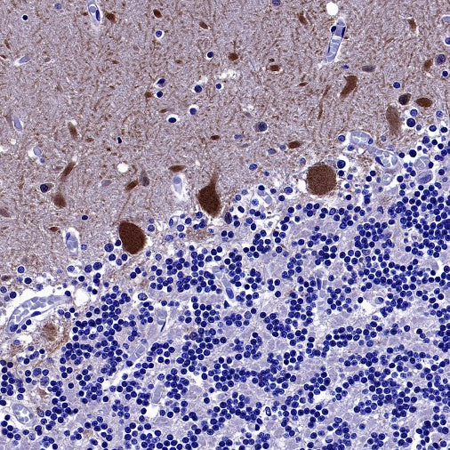 Parvalbumin Recombinant Rabbit mAb (S-1620-10)
