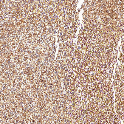 GOT2 Recombinant Rabbit mAb