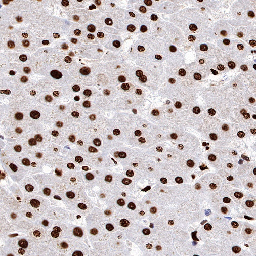 H2AFY Recombinant Rabbit mAb (S-1256-35)