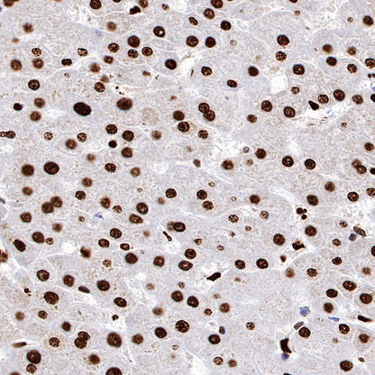 H2AFY Recombinant Rabbit mAb (S-1256-35)