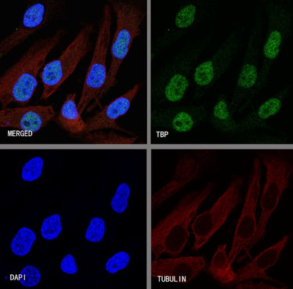 TBP Recombinant Rabbit mAb (S-886-57)