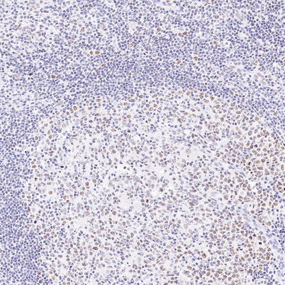 Caspase-8 Recombinant Rabbit mAb (S-2676-74)