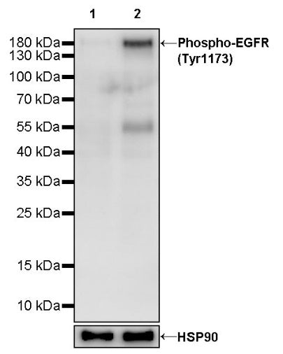 Phospho-EGFR (Tyr1173) Recombinant Rabbit mAb (S-1187-135)