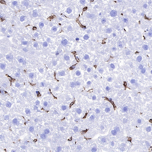 Iba1 Recombinant Rabbit mAb (S-484-18)