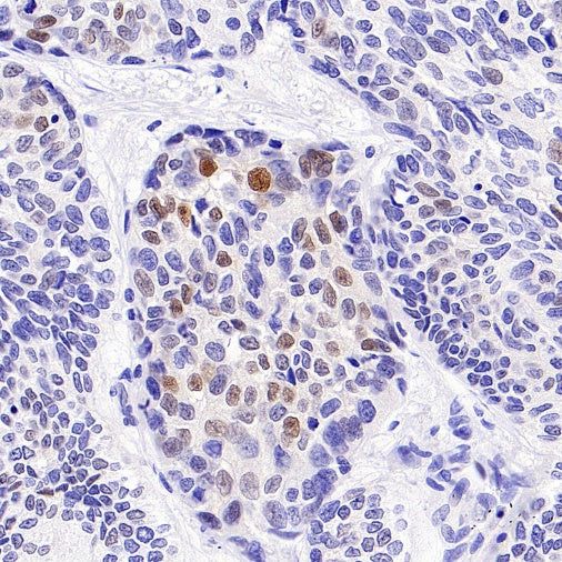 p21 Waf1/Cip1 Recombinant Rabbit mAb (SDT-1349-71)