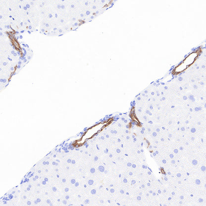Cytokeratin 7 Recombinant Rabbit mAb (S-5954)
