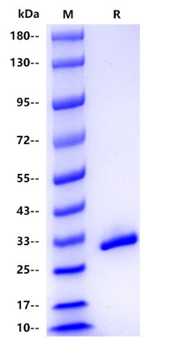 Human Calretinin Protein, His tag