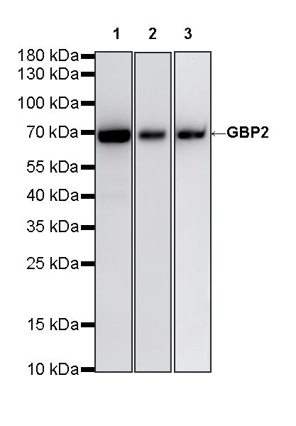 GBP2 Recombinant Rabbit mAb