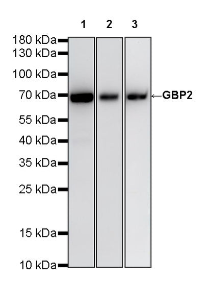 GBP2 Recombinant Rabbit mAb