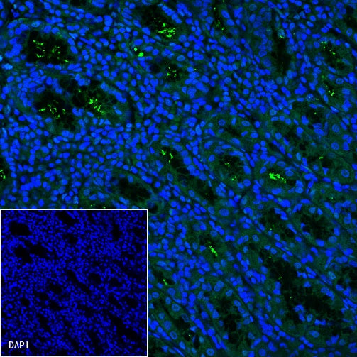 S-RMab® Helicobacter pylori Recombinant Rabbit mAb (FITC Conjugate) (S-R273)