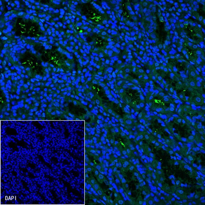 S-RMab® Helicobacter pylori Recombinant Rabbit mAb (FITC Conjugate) (S-R273)