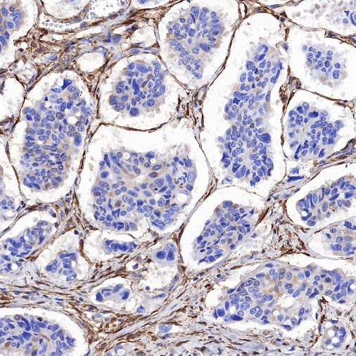 Galectin-1/LGALS1 Rabbit Polyclonal Antibody
