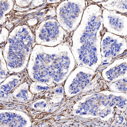Galectin-1/LGALS1 Rabbit Polyclonal Antibody