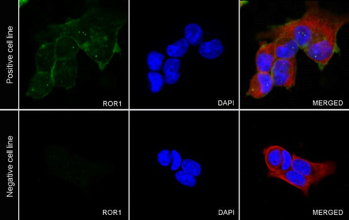 ROR1 Recombinant Rabbit mAb (SDT-R502)