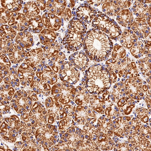 PBR/TSPO Recombinant Rabbit mAb (S-607-19)