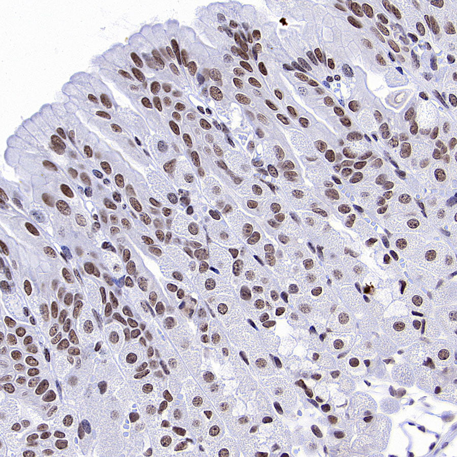 PTBP1 Rabbit Polyclonal Antibody