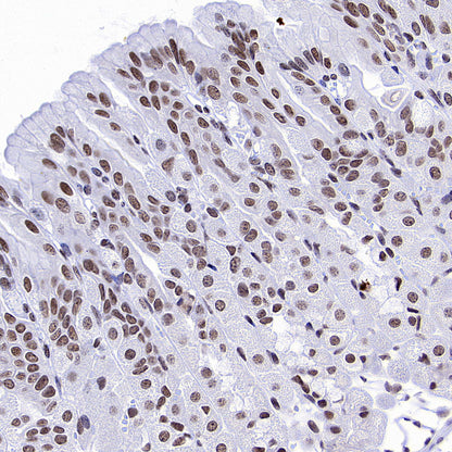 PTBP1 Rabbit Polyclonal Antibody
