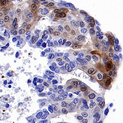Phospho-p44/42 MAPK (Erk1/2) (Thr202/Tyr204) Recombinant Rabbit mAb (S-5119)