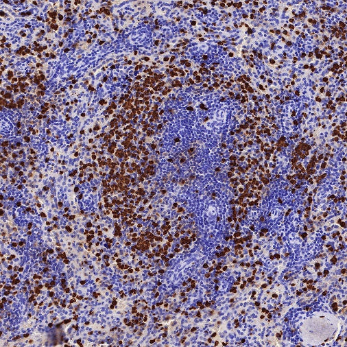 S100A8/MRP8 Recombinant Rabbit mAb (S-R251)