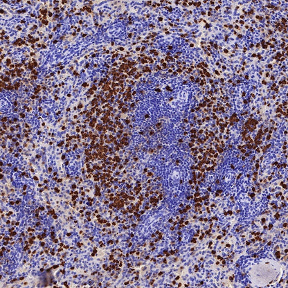S100A8/MRP8 Recombinant Rabbit mAb (S-R251)