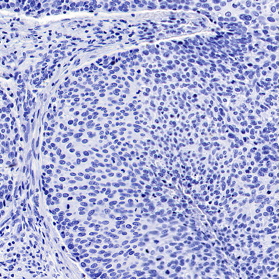 SV2A Recombinant Rabbit mAb (S-4049-16)