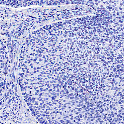SV2A Recombinant Rabbit mAb (S-4049-16)