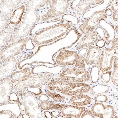 Thioredoxin/TRX Recombinant Rabbit mAb (S-1862-26)